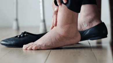 أسباب تشنجات عضلات الساق وطرق الوقاية والعلاج